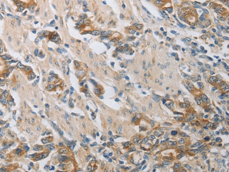 CST3 Polyclonal Antibody Store at -20°C