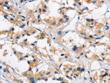 Cathepsin L Polyclonal Antibody Store at -20°C