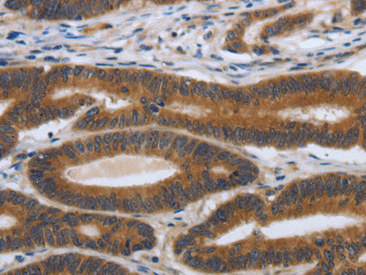 PDGFA Polyclonal Antibody Store at -20°C