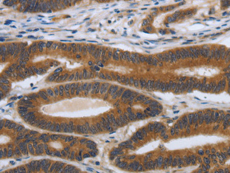PDGFA Polyclonal Antibody Store at -20°C