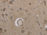 MARK4 Polyclonal Antibody