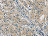 PKD1 Polyclonal Antibody Store at -20°C
