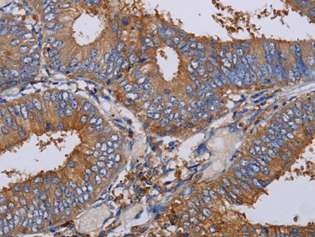 LIMS1 Polyclonal Antibody