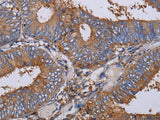 LIMS1 Polyclonal Antibody