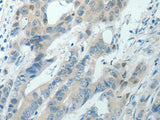 RNF126 Polyclonal Antibody Store at -20°C
