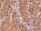 ABI1 Polyclonal Antibody Store at -20°C