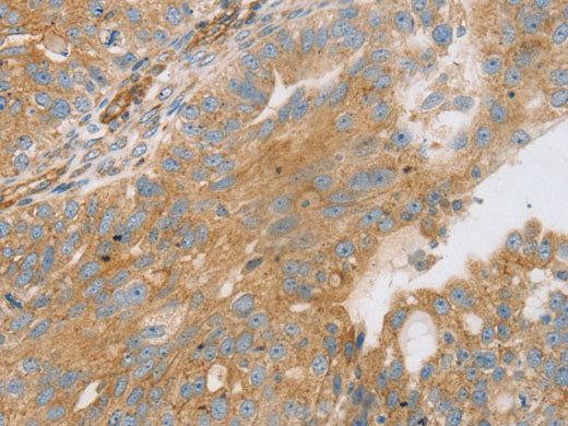 STX16 Polyclonal Antibody Store at -20°C