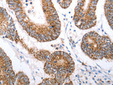 HCRTR1 Polyclonal Antibody Store at -20°C