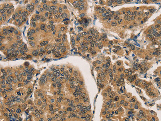 CTNNBIP1 Polyclonal Antibody