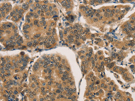 CTNNBIP1 Polyclonal Antibody