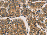CTNNBIP1 Polyclonal Antibody