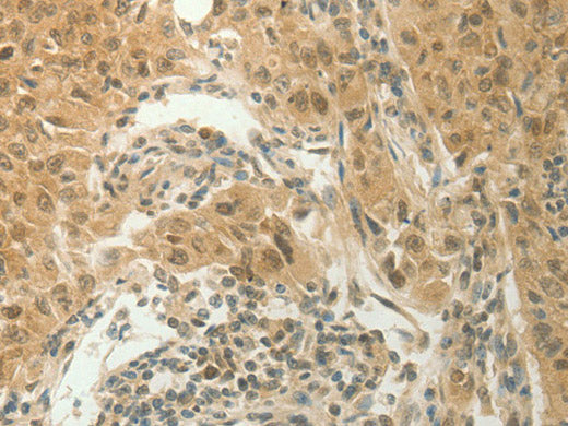 SLC8A3 Polyclonal Antibody Store at -20°C