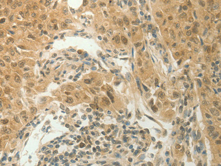 SLC8A3 Polyclonal Antibody Store at -20°C