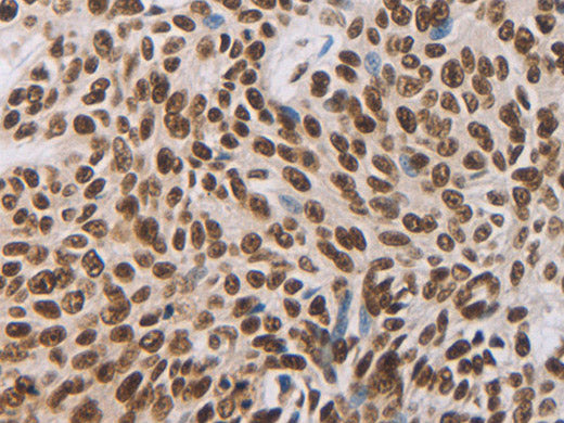 AKAP8 Polyclonal Antibody Store at -20°C
