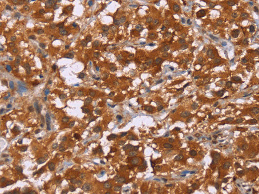 DCBLD2 Polyclonal Antibody Store at -20°C