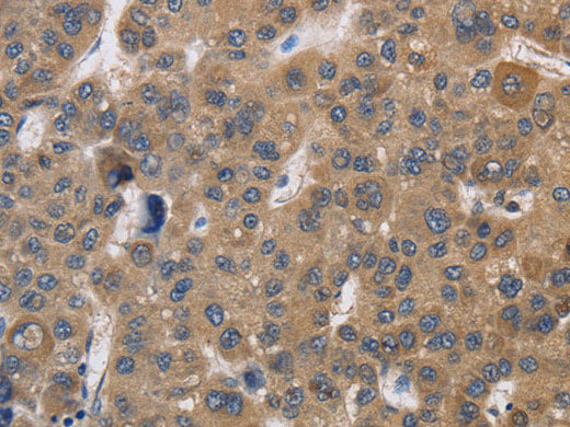 SDCCAG3 Polyclonal Antibody