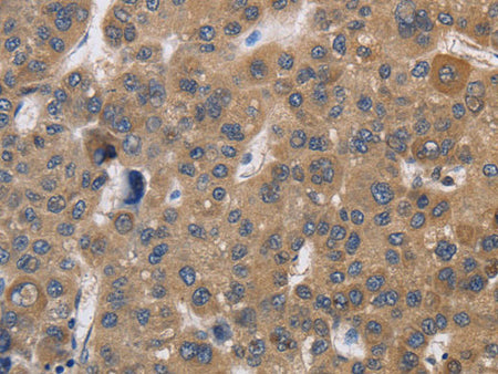 SDCCAG3 Polyclonal Antibody