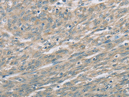 EDA2R Polyclonal Antibody Store at -20°C