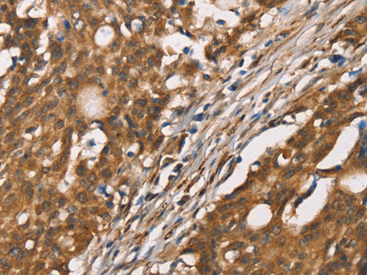 DICER1 Polyclonal Antibody Store at -20°C