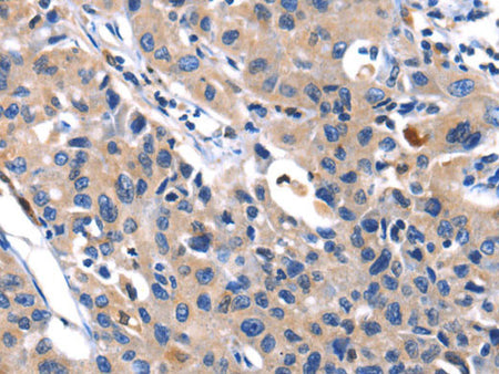 MMP16 Polyclonal Antibody Store at -20°C