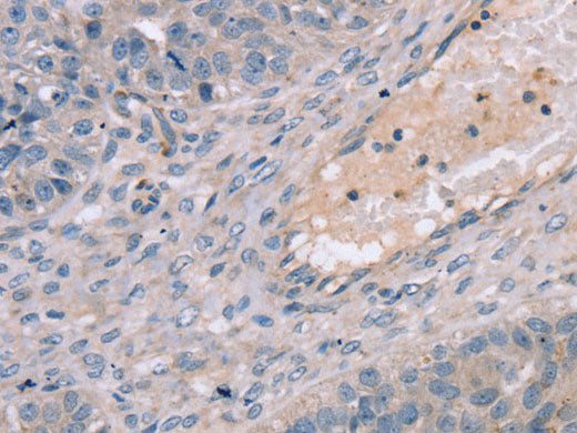 TERT Polyclonal Antibody Store at -20°C