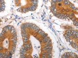 SLC12A6 Polyclonal Antibody Store at -20°C
