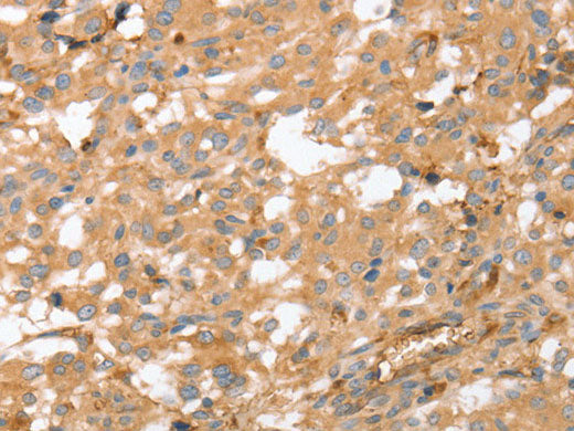 AHSG Polyclonal Antibody Store at -20°C