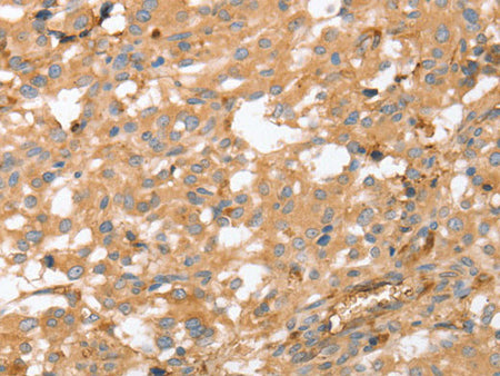 AHSG Polyclonal Antibody Store at -20°C