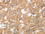 AHSG Polyclonal Antibody Store at -20°C