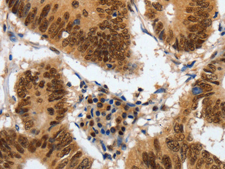 COPS5 Polyclonal Antibody Store at -20°C