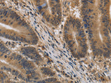 KIF22 Polyclonal Antibody Store at -20°C