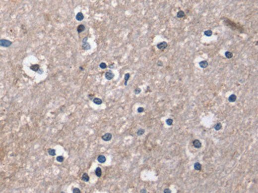 DUT Polyclonal Antibody Store at -20°C