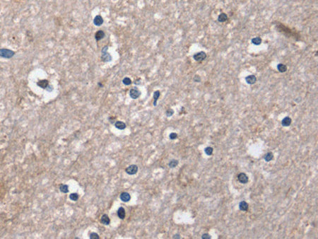 DUT Polyclonal Antibody Store at -20°C