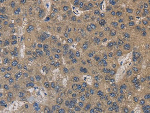 EMC8 Polyclonal Antibody Store at -20°C