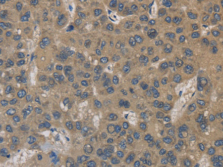 EMC8 Polyclonal Antibody Store at -20°C