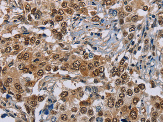 GTF2I Polyclonal Antibody Store at -20°C