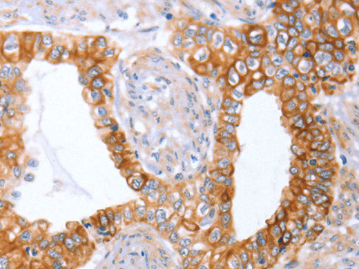 ABO Polyclonal Antibody Store at -20°C