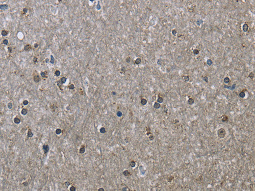 HSPA9 Polyclonal Antibody Store at -20°C