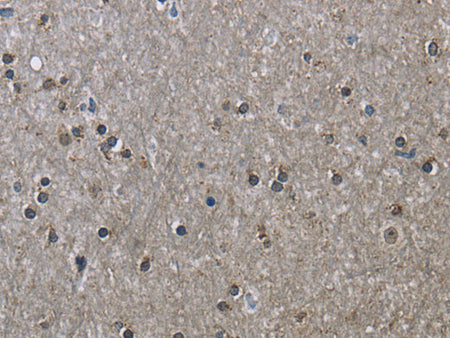 HSPA9 Polyclonal Antibody Store at -20°C