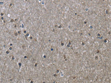 HSPA9 Polyclonal Antibody Store at -20°C