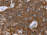 GRPR Polyclonal Antibody