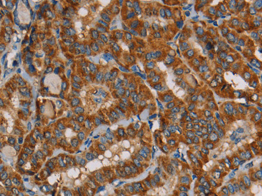 MRPL39 Polyclonal Antibody Store at -20°C