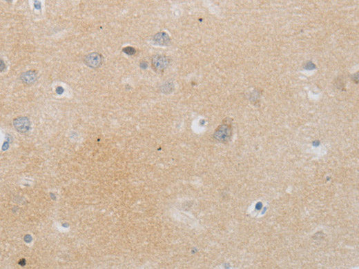 MMP25 Polyclonal Antibody Store at -20°C