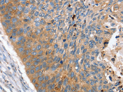 REG3A Polyclonal Antibody Store at -20°C - Biomarkers - Elabscience Biotechnology - MSE Supplies