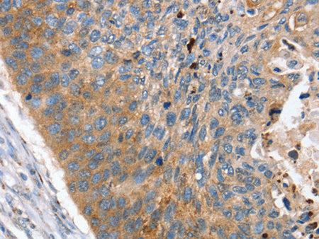 REG3A Polyclonal Antibody Store at -20°C - Biomarkers - Elabscience Biotechnology - MSE Supplies