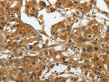 AKAP12 Polyclonal Antibody