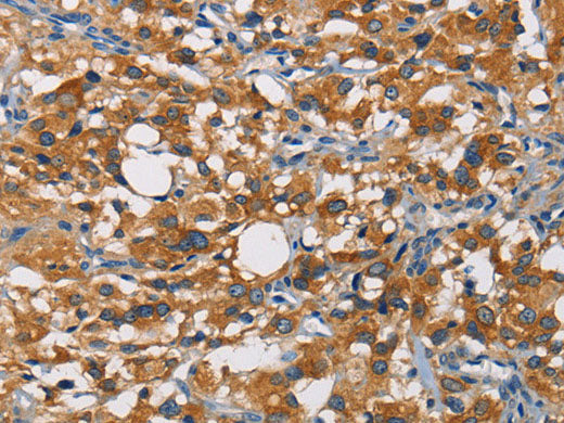 CRTAM Polyclonal Antibody