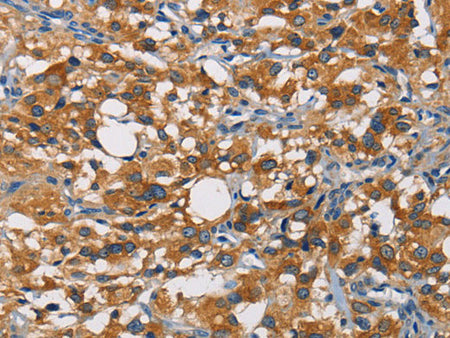 CRTAM Polyclonal Antibody
