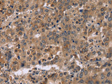 FAM107A Polyclonal Antibody Store at -20°C
