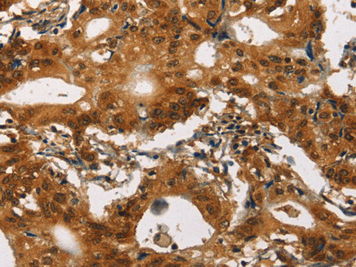 Cav1.2 Polyclonal Antibody
